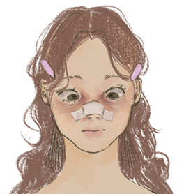 A teenage girl is recovering from undergoing a rhinoplasty.

Illustration by Annabelle Cheung